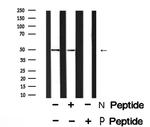Phospho-GFAP (Ser13) Antibody in Western Blot (WB)