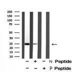 Phospho-HP1 beta (Thr51) Polyclonal Antibody