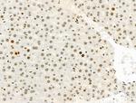 Phospho-MCM2 (Ser139) Antibody in Immunohistochemistry (Paraffin) (IHC (P))