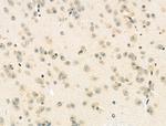 Phospho-MyD88 (Tyr257) Polyclonal Antibody