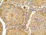 Phospho-Nudel (Thr219) Polyclonal Antibody