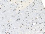 Phospho-NPM1 (Ser4) Antibody in Immunohistochemistry (Paraffin) (IHC (P))