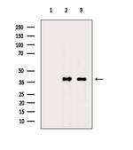 Phospho-NPM1 (Ser70) Polyclonal Antibody