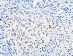 Phospho-NPM1 (Thr237) Antibody in Immunohistochemistry (Paraffin) (IHC (P))