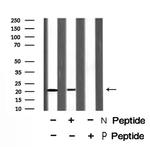 Phospho-p21 (Thr57) Polyclonal Antibody