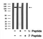Phospho-PDE3A (Ser312) Polyclonal Antibody