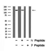 Phospho-Raptor (Ser863) Polyclonal Antibody
