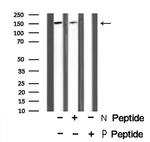Phospho-RON (Tyr1353) Polyclonal Antibody