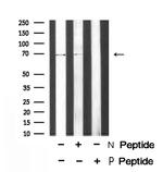 Phospho-Torc1 (Ser151) Polyclonal Antibody