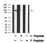Phospho-Axl (Tyr698) Antibody in Western Blot (WB)