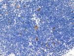 Phospho-Axl (Tyr702) Polyclonal Antibody