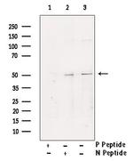 Phospho-YBX1 (Ser102) Polyclonal Antibody