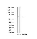 Phospho-SQSTM1 (Ser28) Antibody in Western Blot (WB)