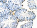 Phospho-Creatine Kinase BB (Ser199) Polyclonal Antibody