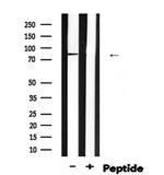 Phospho-EZH2 (Ser474) Polyclonal Antibody