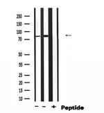Phospho-EZH2 (Thr369) Antibody in Western Blot (WB)