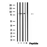 Phospho-EZH2 (Thr367) Polyclonal Antibody