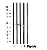 Phospho-HPD (Thr382) Polyclonal Antibody