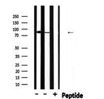Phospho-PFKP (Tyr52) Polyclonal Antibody