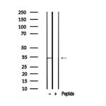 Phospho-PRPS1 (Ser180) Antibody in Western Blot (WB)