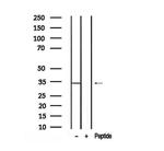 Phospho-KHK isoform A (Ser80) Polyclonal Antibody