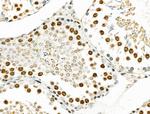 Phospho-BCLAF1 (Ser512) Antibody in Immunohistochemistry (Paraffin) (IHC (P))