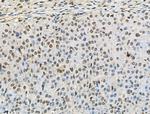 Phospho-BCLAF1 (Ser512) Antibody in Immunohistochemistry (Paraffin) (IHC (P))