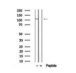 Phospho-BCLAF1 (Ser512) Antibody in Western Blot (WB)