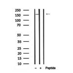 Phospho-DEPDC5 (Ser1530) Antibody in Western Blot (WB)