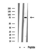 KV3.4 (KCNC4) Antibody in Western Blot (WB)