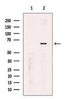 PNK Polyclonal Antibody