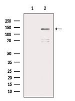 ABL1/ABL2 Antibody in Western Blot (WB)