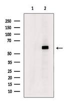 DYRK2/DYRK4 Polyclonal Antibody