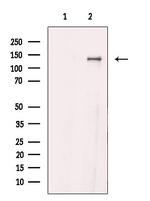 HIPK1/HIPK2/HIPK3 Antibody in Western Blot (WB)