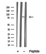ARK5 Antibody in Western Blot (WB)