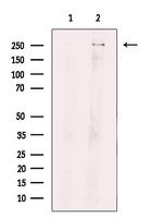 ROS1 Polyclonal Antibody