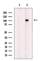 FGFR1/FGFR2 Polyclonal Antibody