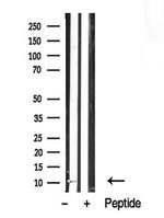PDE6 gamma Antibody in Western Blot (WB)