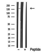 LTK/ALK Antibody in Western Blot (WB)