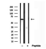 PFKFB3 Antibody in Western Blot (WB)