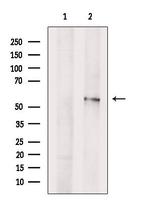 PFKFB3 Antibody in Western Blot (WB)