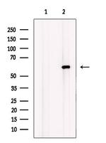 LPCAT1 Polyclonal Antibody