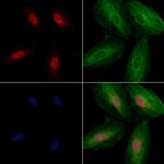 SGTA Antibody in Immunocytochemistry (ICC/IF)