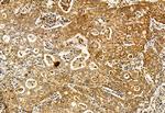 S100A14 Antibody in Immunohistochemistry (Paraffin) (IHC (P))