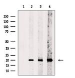 TIMM23 Polyclonal Antibody