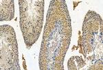CRBN Polyclonal Antibody