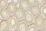 CRBN Antibody in Immunohistochemistry (Paraffin) (IHC (P))