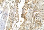 DHRS3 Polyclonal Antibody