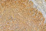 MCD Antibody in Immunohistochemistry (Paraffin) (IHC (P))