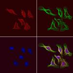 TCP-1 gamma Polyclonal Antibody